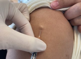 เชฟรอนสนับสนุนศูนย์วิจัยคลินิกศิริราช ศึกษาฉีดวัคซีนโควิด-19 เข้าในชั้นผิวหนัง